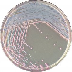 法国科玛嘉金黄色葡萄球菌显色培养基 分析试剂2