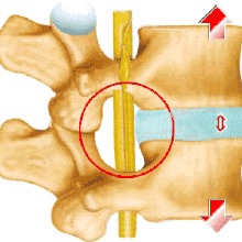 膝关节滑膜炎治疗方法 其他作业保护2
