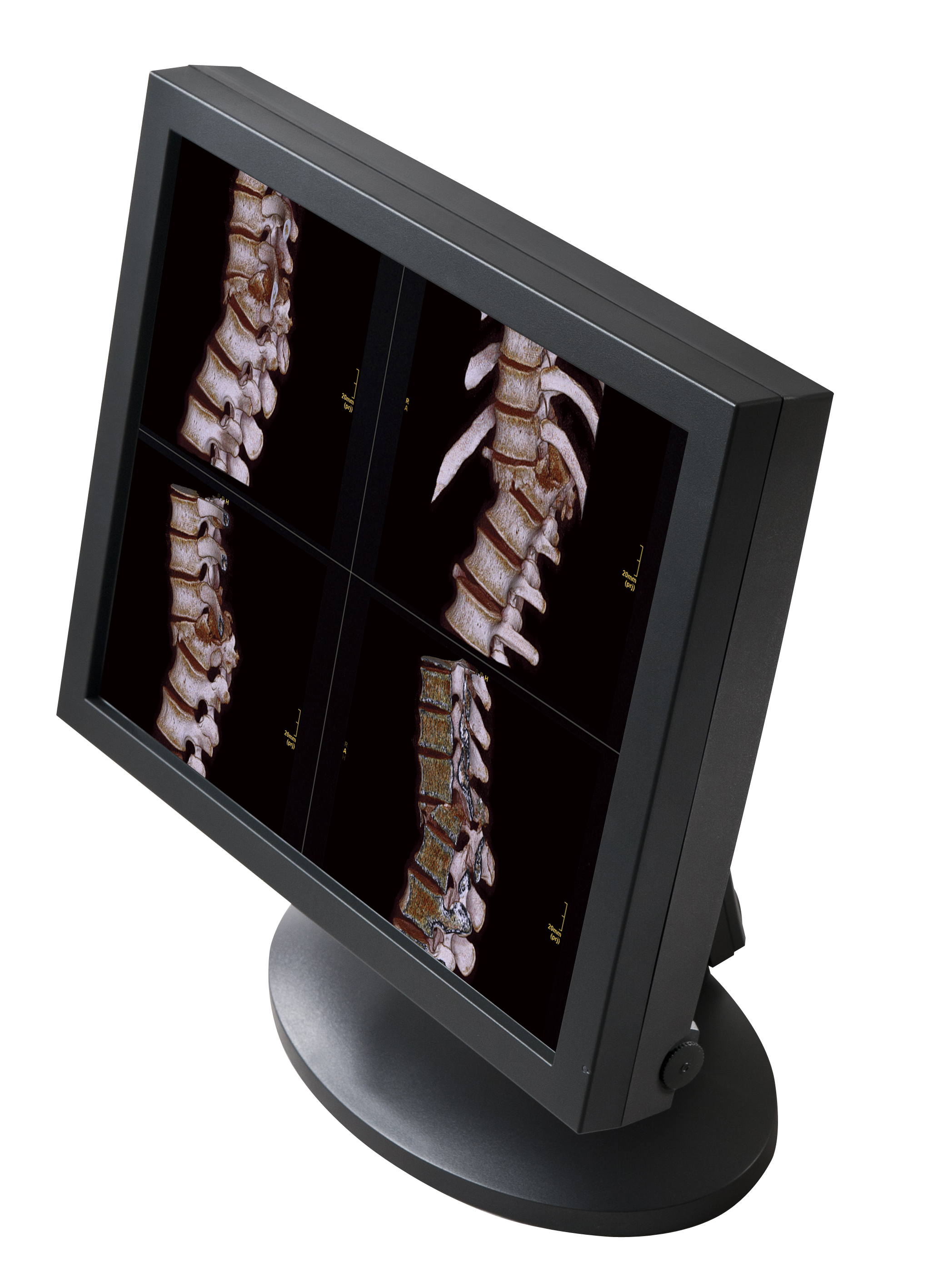 GE磁共振西门子核磁飞利浦核磁联影磁共振MRI医用显示器6M双屏4M双屏6M一体化双屏3