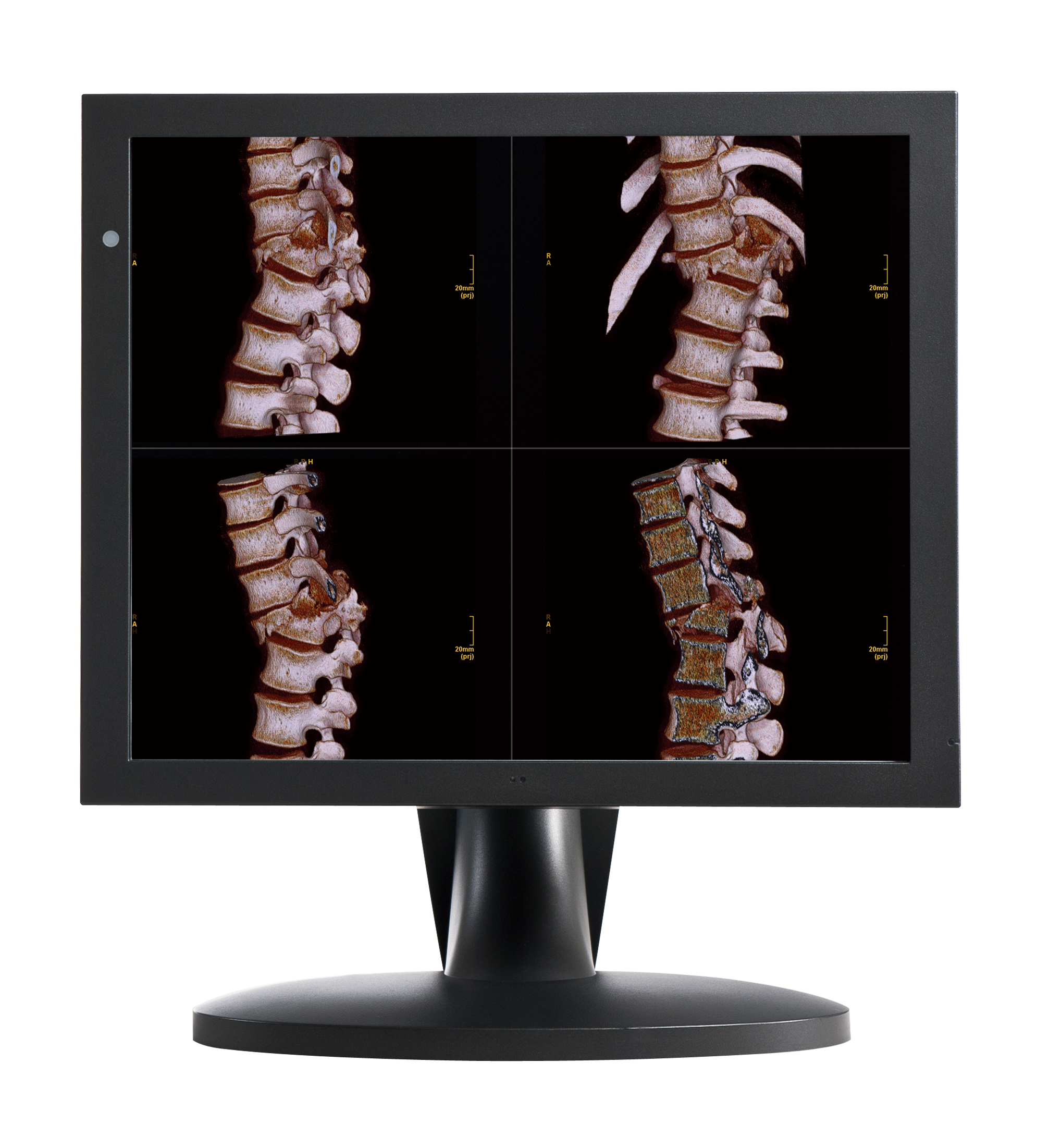 GE磁共振西门子核磁飞利浦核磁联影磁共振MRI医用显示器6M双屏4M双屏6M一体化双屏2