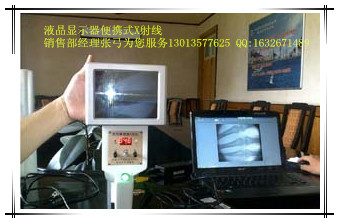 一种多用途的便携式X射线机多用途X光机手提式X光机张弓便携X光机130的13577625GDX4