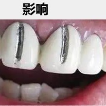 其他商务服务 种植牙可以做核磁共振吗 北京维尔口腔刘志杰解析