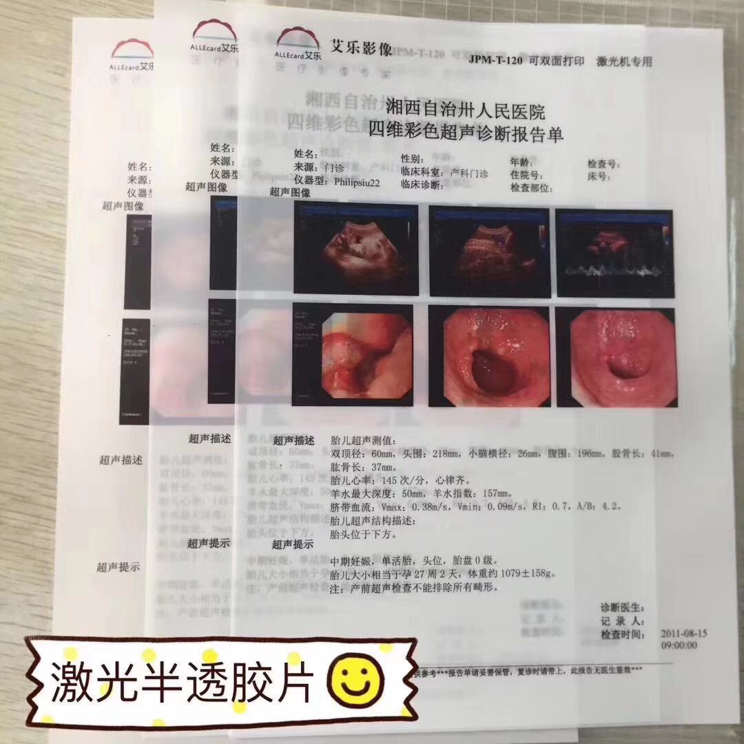 上海医用胶片厂家 供应医用胶片 医用胶片自助取片机 超声科 适用放射科4